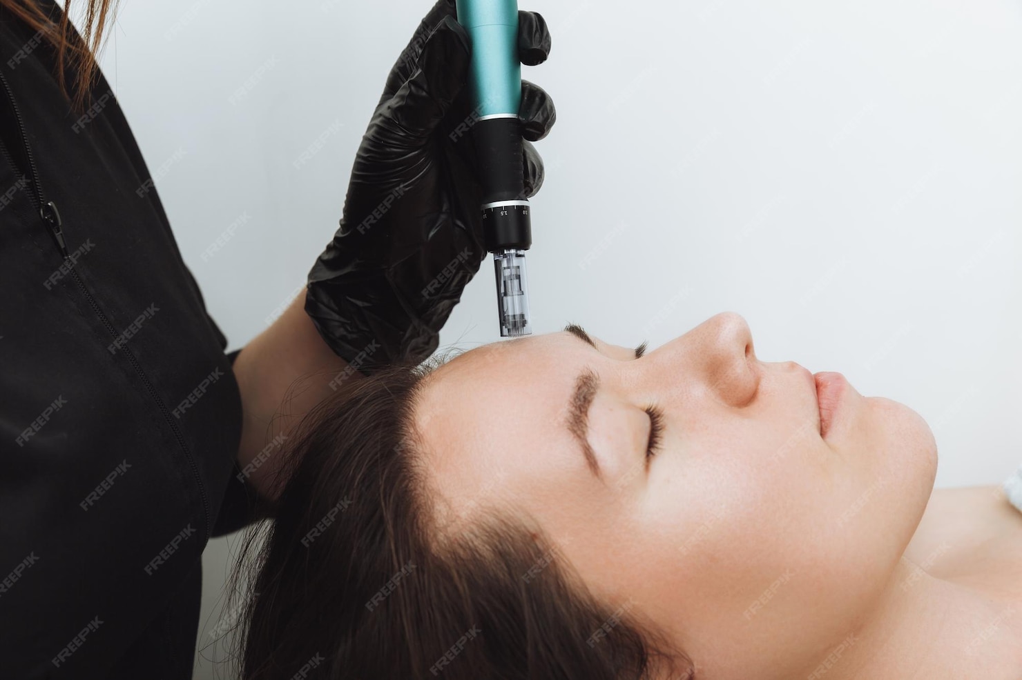 SKIN TIGHTENING TREATMENTS WITH MICRONEEDLING IN LONG ISLAND.