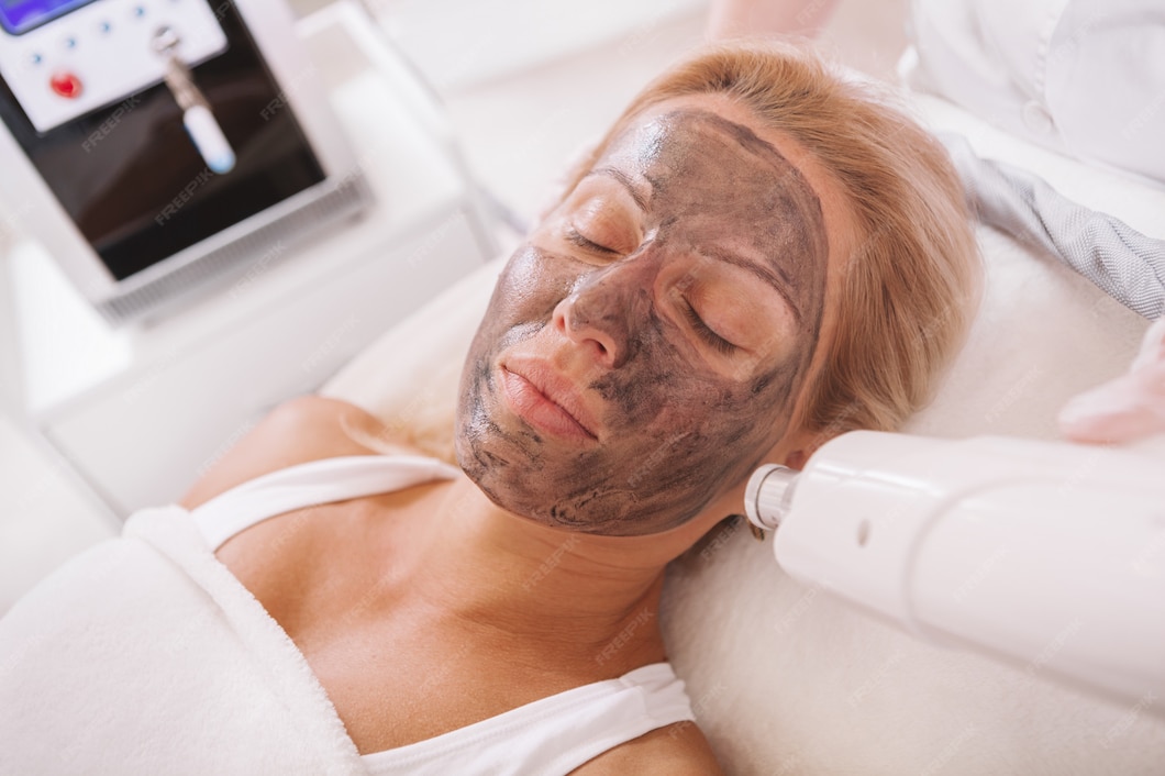 HEMICAL PEEL fOR HYPERPIGMENTATION TREATMENT IN NY.